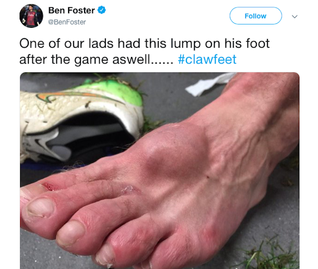 Nasty Foot